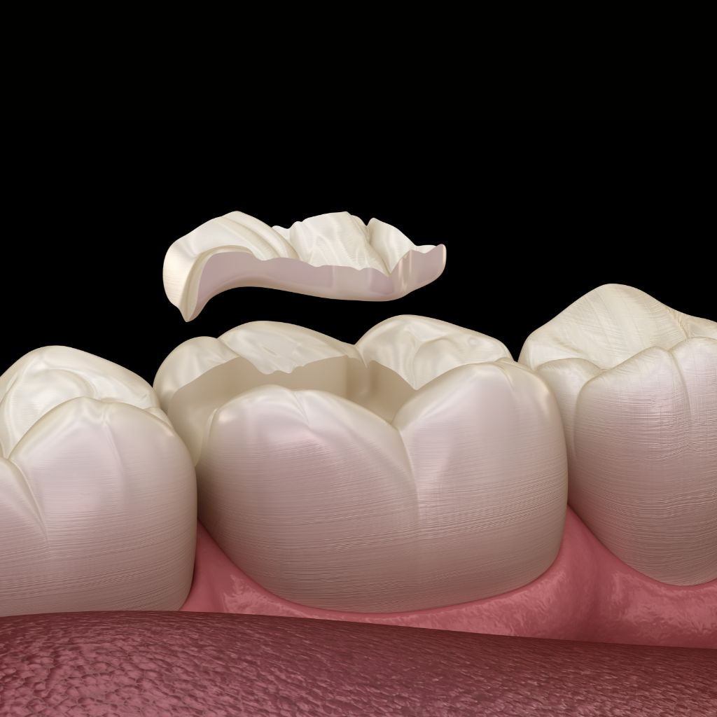 dentisteria e reabilitação oral estética