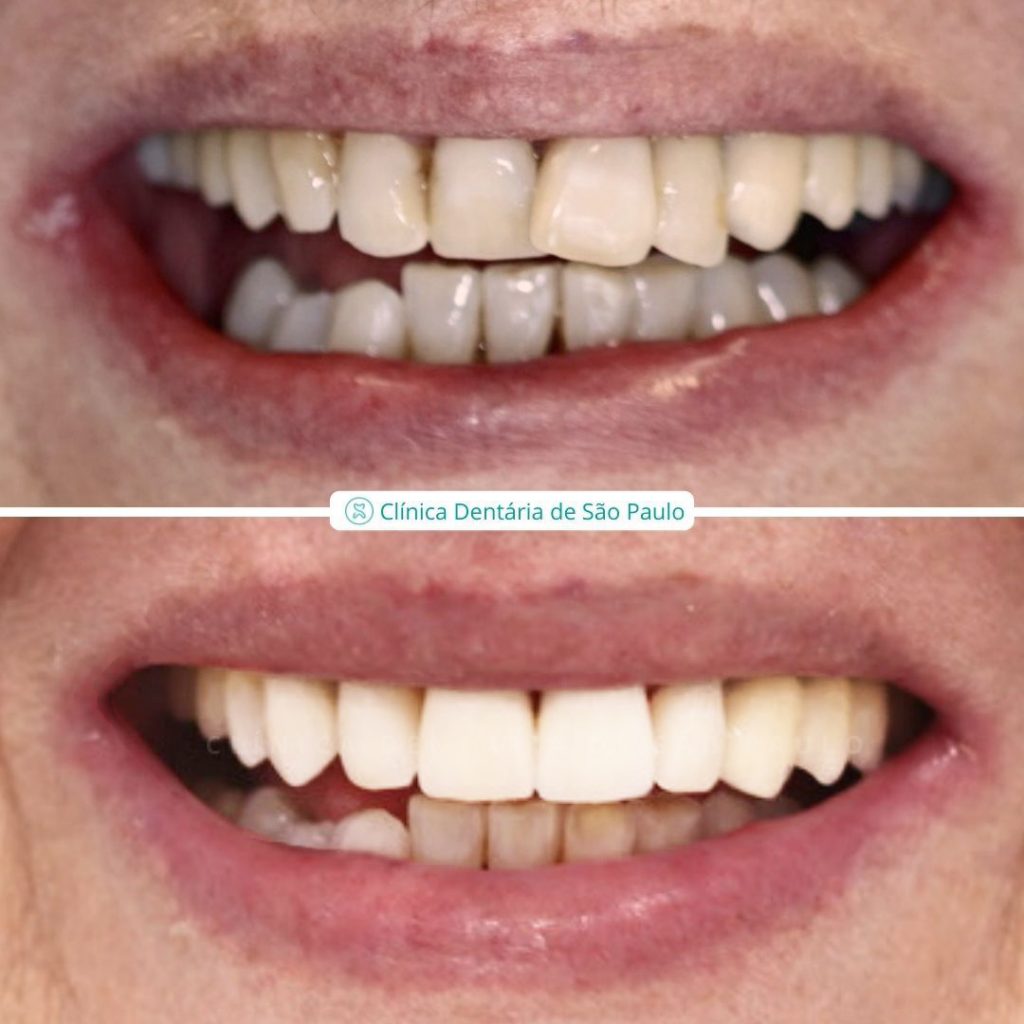 dentisteria & ortodontia - Caso 1