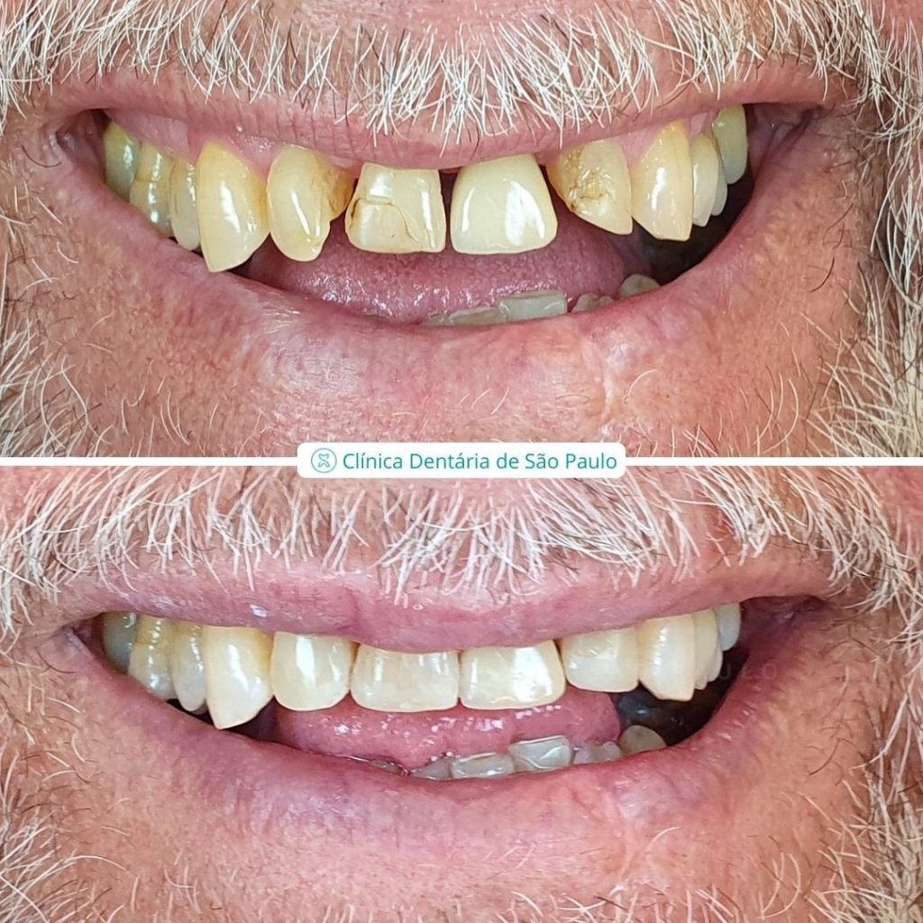 Dentisteria - Caso 1