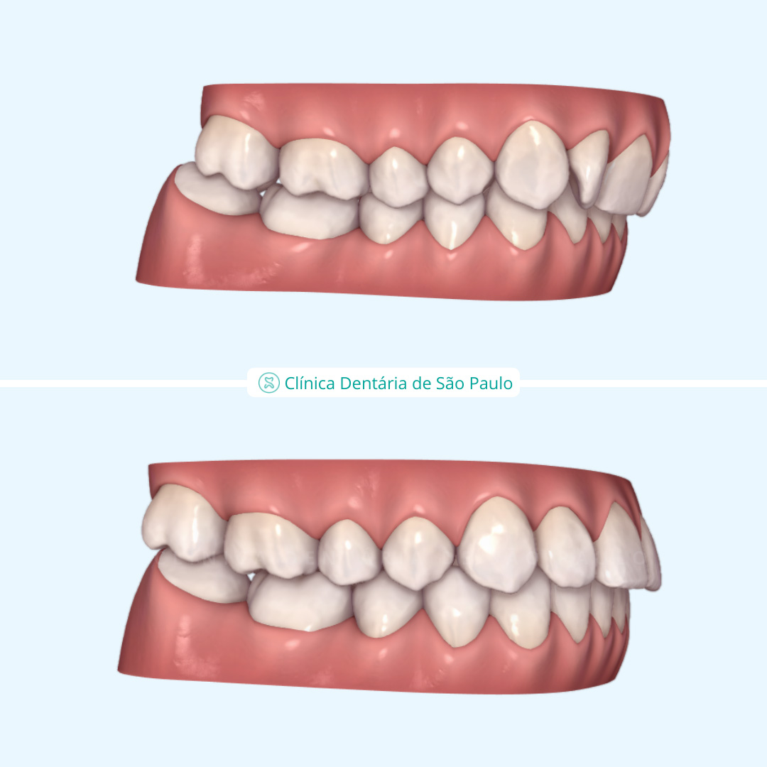 ortodontia - caso 5