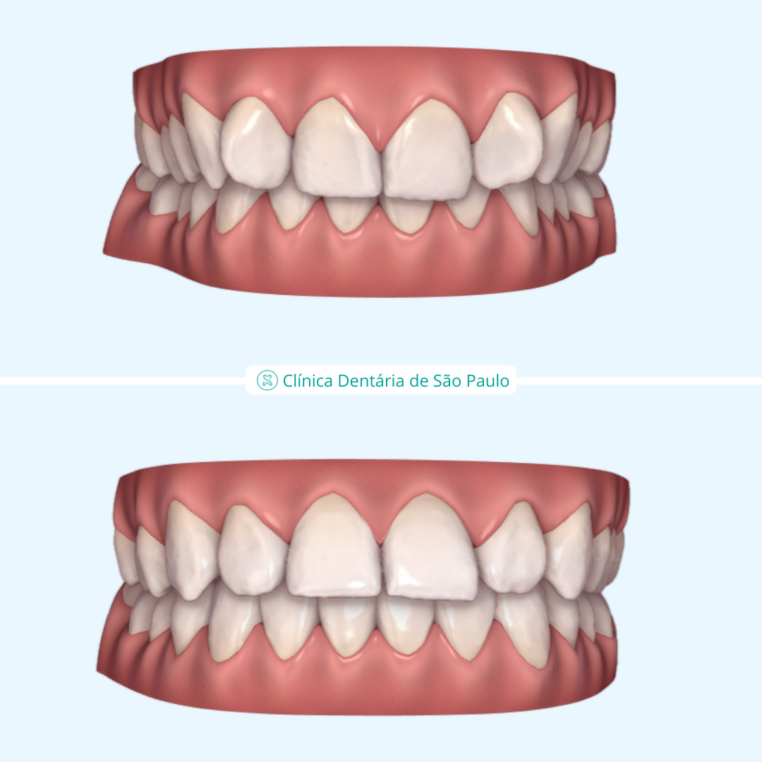 ortodontia - caso 5
